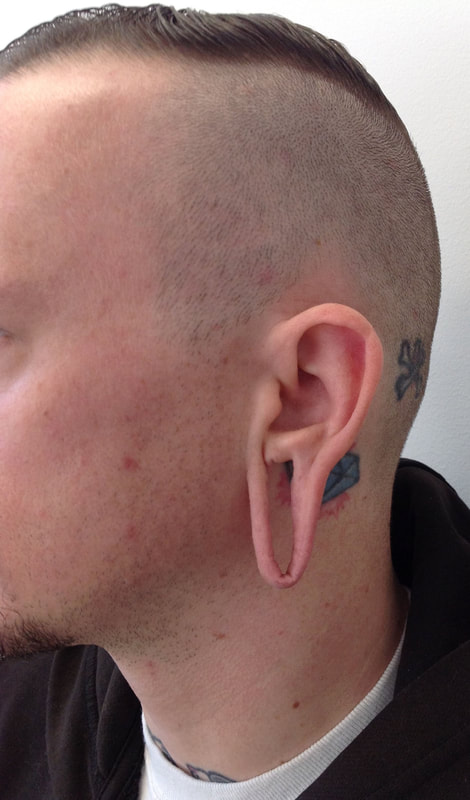 Torn ear lobe solutions, monster backs and more